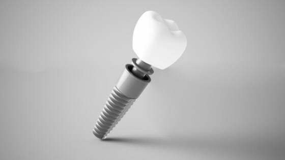 Animated components of dental implant supported dental crowns